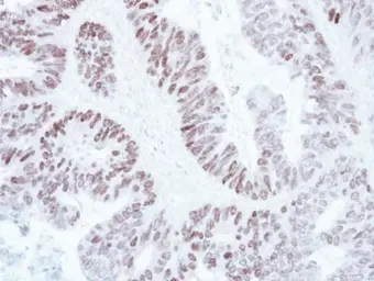 Anti-SATB1 antibody [C2C3], C-term used in IHC (Paraffin sections) (IHC-P). GTX114738