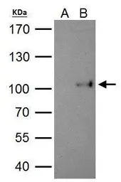 Anti-SATB1 antibody [C2C3], C-term used in Immunoprecipitation (IP). GTX114738