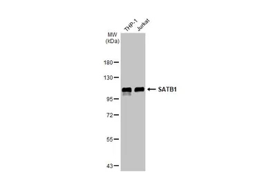 Anti-SATB1 antibody [C2C3], C-term used in Western Blot (WB). GTX114738