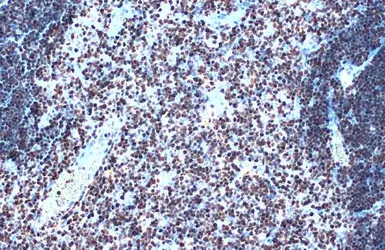 Anti-SATB1 antibody [C2C3], C-term used in IHC (Paraffin sections) (IHC-P). GTX114738