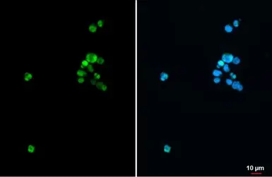 Anti-SATB1 antibody [C2C3], C-term used in Immunocytochemistry/ Immunofluorescence (ICC/IF). GTX114738