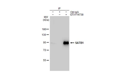 Anti-SATB1 antibody [C2C3], C-term used in Immunoprecipitation (IP). GTX114738