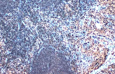 Anti-SATB1 antibody [C2C3], C-term used in IHC (Paraffin sections) (IHC-P). GTX114738