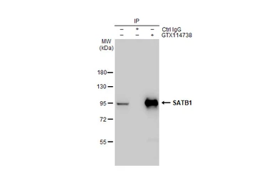 Anti-SATB1 antibody [C2C3], C-term used in Immunoprecipitation (IP). GTX114738