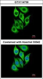 Anti-SerpinB3 antibody [N2C3] used in Immunocytochemistry/ Immunofluorescence (ICC/IF). GTX114739