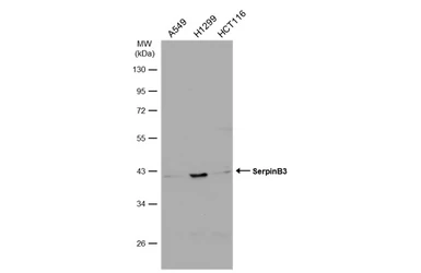 Anti-SerpinB3 antibody [N2C3] used in Western Blot (WB). GTX114739