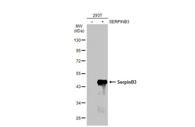 Anti-SerpinB3 antibody [N2C3] used in Western Blot (WB). GTX114739