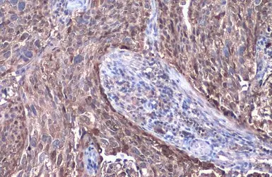 Anti-SerpinB3 antibody [N2C3] used in IHC (Paraffin sections) (IHC-P). GTX114739