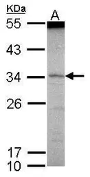 Anti-SCML1 antibody [N2C3] used in Western Blot (WB). GTX114740
