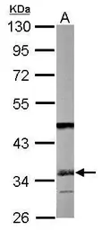 Anti-SGTA antibody [N2C3] used in Western Blot (WB). GTX114755