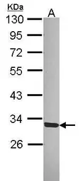 Anti-SGTA antibody [N2C3] used in Western Blot (WB). GTX114755