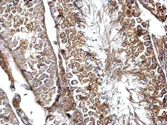 Anti-SH3GL3 antibody used in IHC (Paraffin sections) (IHC-P). GTX114758