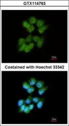 Anti-Slap antibody used in Immunocytochemistry/ Immunofluorescence (ICC/IF). GTX114763