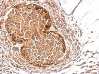 Anti-Slap antibody used in IHC (Paraffin sections) (IHC-P). GTX114763