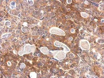 Anti-Slap antibody used in IHC (Paraffin sections) (IHC-P). GTX114763