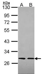 Anti-Slap antibody used in Western Blot (WB). GTX114763