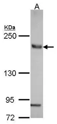 Anti-AE2 antibody [N2N3] used in Western Blot (WB). GTX114768