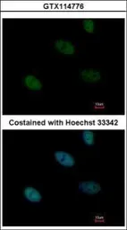 Anti-HLTF antibody [N2C1], Internal used in Immunocytochemistry/ Immunofluorescence (ICC/IF). GTX114776