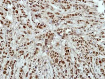 Anti-HLTF antibody [N2C1], Internal used in IHC (Paraffin sections) (IHC-P). GTX114776