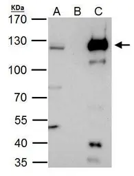 Anti-HLTF antibody [N2C1], Internal used in Immunoprecipitation (IP). GTX114776