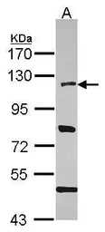 Anti-HLTF antibody [N2C1], Internal used in Western Blot (WB). GTX114776