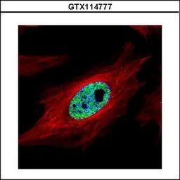 Anti-SMARCC1 antibody [C2C3], C-term used in Immunocytochemistry/ Immunofluorescence (ICC/IF). GTX114777