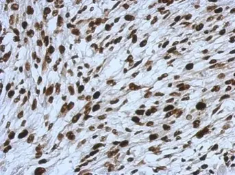 Anti-SMARCC1 antibody [C2C3], C-term used in IHC (Paraffin sections) (IHC-P). GTX114777