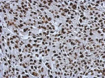 Anti-SMARCC1 antibody [C2C3], C-term used in IHC (Paraffin sections) (IHC-P). GTX114777