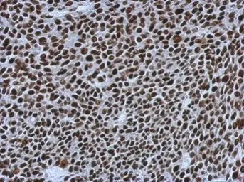 Anti-SMARCC1 antibody [C2C3], C-term used in IHC (Paraffin sections) (IHC-P). GTX114777