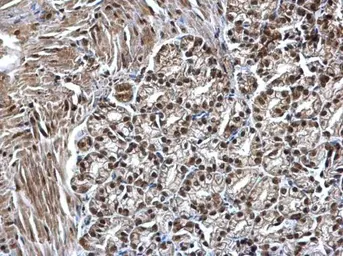 Anti-SMARCC1 antibody [C2C3], C-term used in IHC (Paraffin sections) (IHC-P). GTX114777
