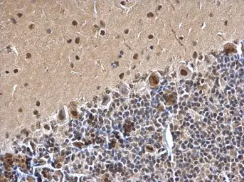 Anti-SMARCC1 antibody [C2C3], C-term used in IHC (Paraffin sections) (IHC-P). GTX114777
