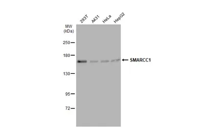 Anti-SMARCC1 antibody [C2C3], C-term used in Western Blot (WB). GTX114777