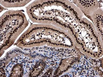 Anti-SMARCC2 / BAF170 antibody used in IHC (Paraffin sections) (IHC-P). GTX114778