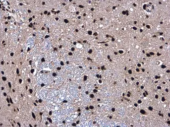 Anti-SMARCC2 / BAF170 antibody used in IHC (Paraffin sections) (IHC-P). GTX114778