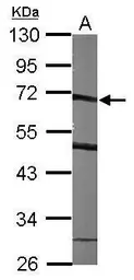 Anti-SMARCD1 antibody [N2C1], Internal used in Western Blot (WB). GTX114780