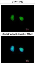 Anti-SMARCD1 antibody [N2C1], Internal used in Immunocytochemistry/ Immunofluorescence (ICC/IF). GTX114780