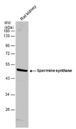 Anti-Spermine synthase antibody [N3C3] used in Western Blot (WB). GTX114783