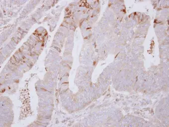 Anti-SNX2 antibody used in IHC (Paraffin sections) (IHC-P). GTX114788