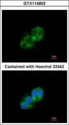 Anti-STAC antibody used in Immunocytochemistry/ Immunofluorescence (ICC/IF). GTX114802