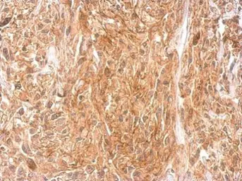 Anti-STAC antibody used in IHC (Paraffin sections) (IHC-P). GTX114802