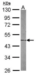 Anti-STAC antibody used in Western Blot (WB). GTX114802