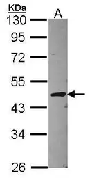 Anti-STAC antibody used in Western Blot (WB). GTX114802