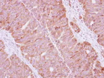Anti-Staufen antibody used in IHC (Paraffin sections) (IHC-P). GTX114803