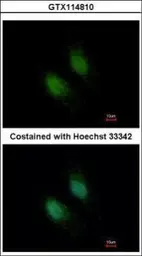 Anti-STXBP2 antibody used in Immunocytochemistry/ Immunofluorescence (ICC/IF). GTX114810