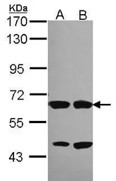 Anti-STXBP2 antibody used in Western Blot (WB). GTX114810