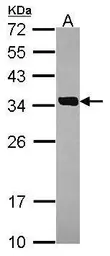 Anti-SULT2A1 antibody [N1C3] used in Western Blot (WB). GTX114814