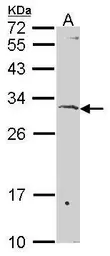 Anti-SURF1 antibody [N2C3] used in Western Blot (WB). GTX114816