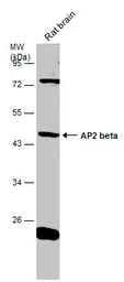 Anti-AP2 beta antibody used in Western Blot (WB). GTX114832