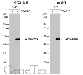 Anti-AP2 gamma antibody used in Western Blot (WB). GTX114833