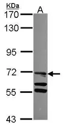 Anti-TLE4 antibody [C1C3] used in Western Blot (WB). GTX114842